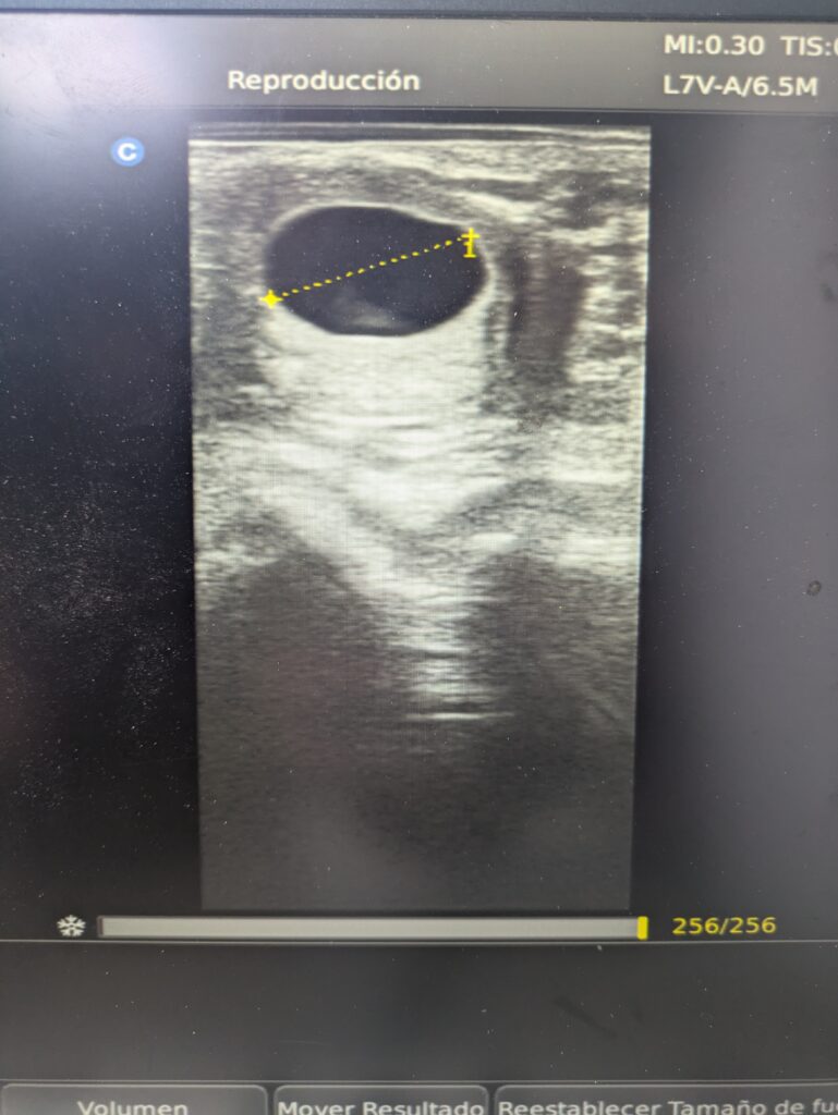 Ecografía de vesícula embrionaria en yegua a los 15 días post inseminación, realizada por veterinario equino en Sevilla.